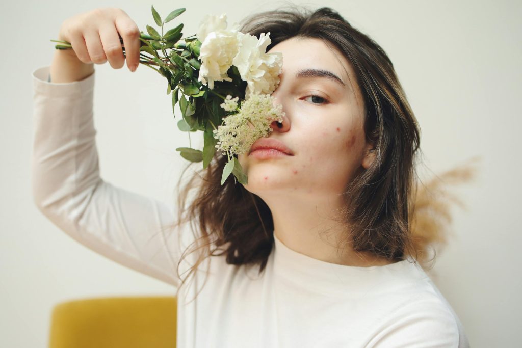 pcos woman poses and embraces hormonal acne 